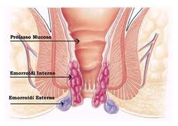 Emorroidi: Anatomia